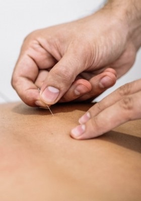 acupuntura dr jose fontes porto