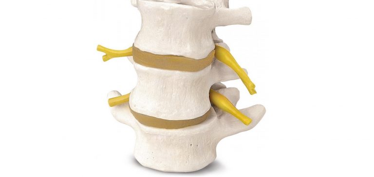tratamento para espondilite anquilosante
