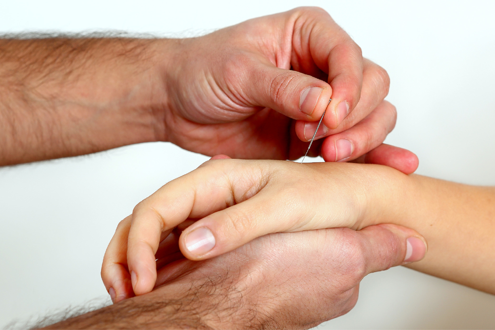 consulta medicina chinesa acupuntura