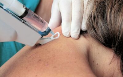 Instabilidade na Coluna e Cervical: Quando a Acupunctura e a Mesoterapia Atuam como Proloterapia