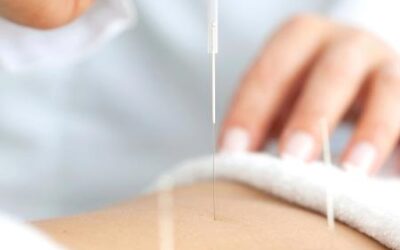 Potenciar o Sucesso da Gravidez com Acupuntura para FIV