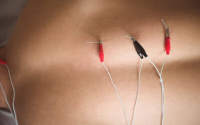 Eletroacupuntura: Potenciar o Alívio da Dor e a Regeneração Neural