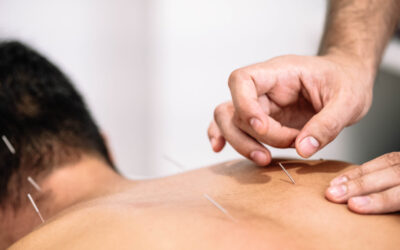 Como é que a Acupuntura Funciona? Parte 2: O “Reset” ao Sistema Nervoso